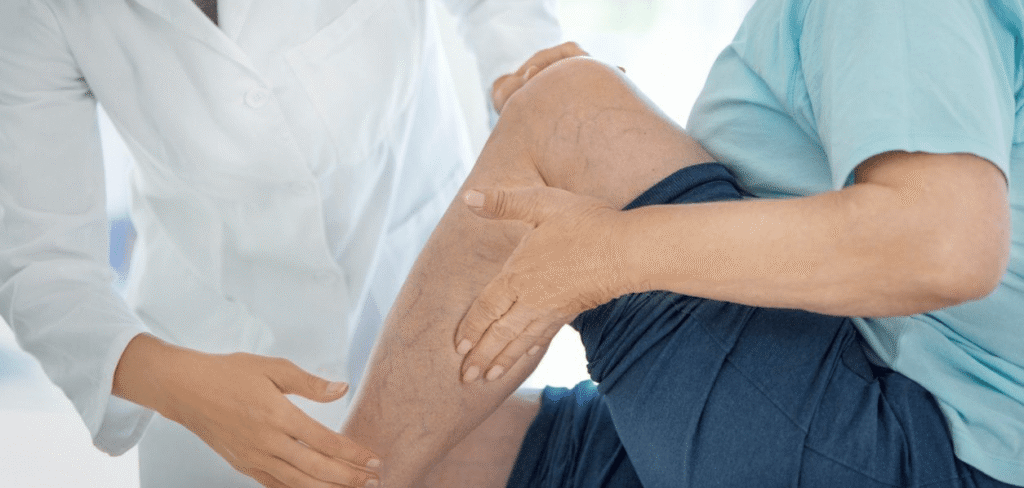 TROMBOSE IM - Trombose: sintomas, e fatores de risco e como evitar